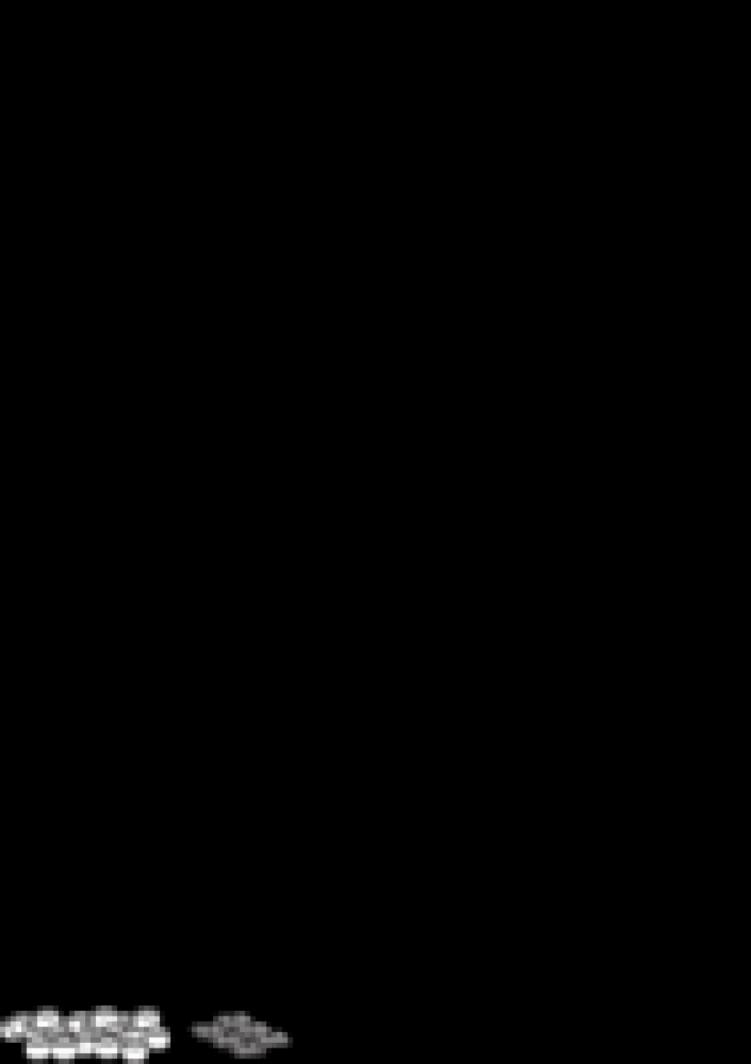 Schallschutzset Montagerahmen