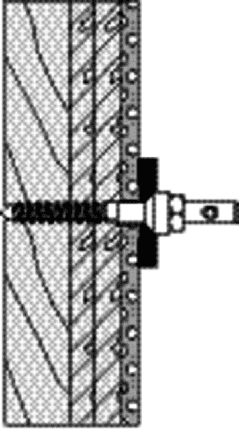 HEWI BM Rückenstütze 801/805 Classic, 1 Bef-P., Leichtbauw./Schichtholzpl.